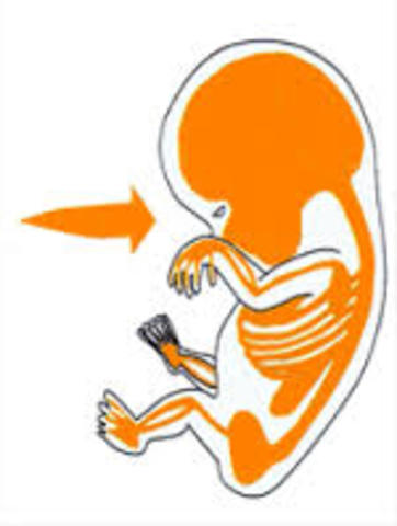 Subtipos del mesodermo 1.1