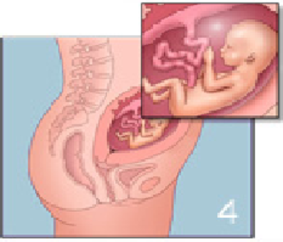 16ª semana (4º mes)