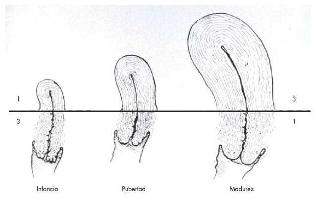 Crecimiento del escroto y testículos.