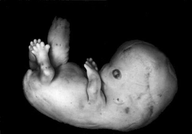 9 semanas. Características internas