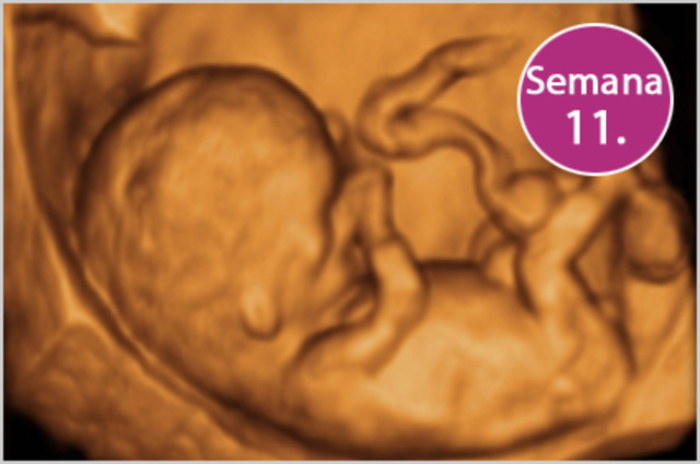 11 semanas. Características externas
