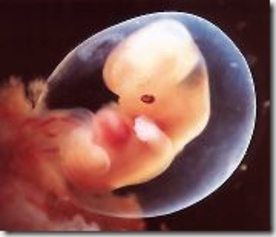 Medida del embrion