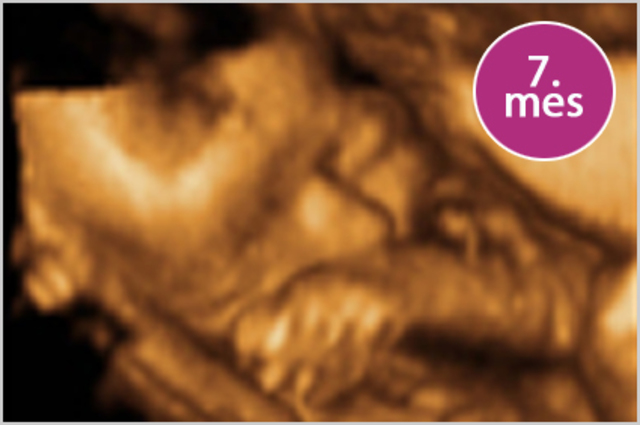 7 meses. Características internas