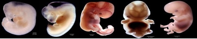 desarrollo (5ta semana)