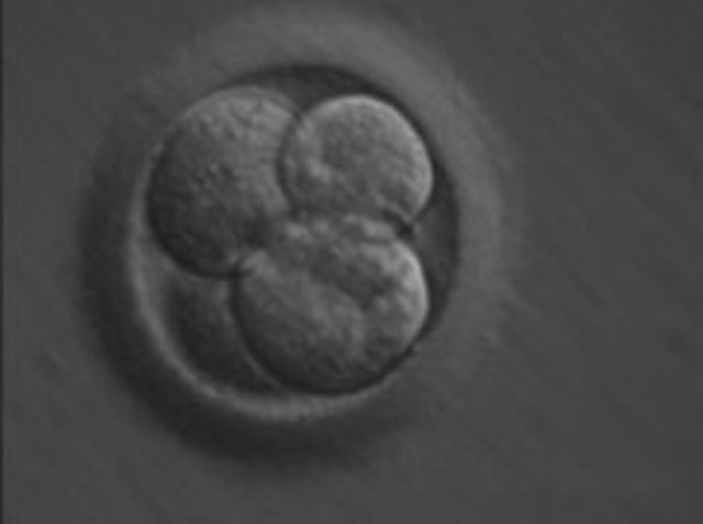 Día 2. Segmentación