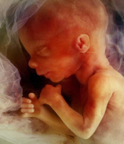 Etapa fetal quinto mes.