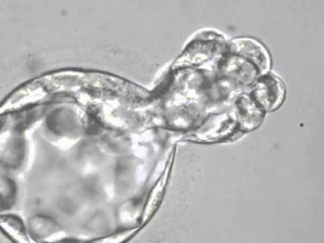 Día 6. Eclosión del blastocisto