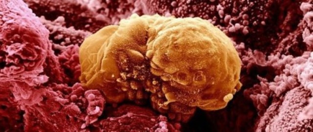 Día 7 Implantación