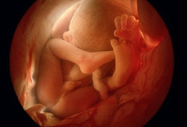 Semana 36 fetal, tercer trimestre. 