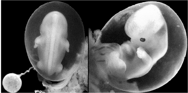 6ta semana (1er mes )