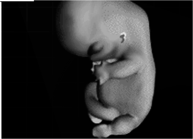 7ta semana (1er mes)