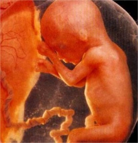 Dieciseisava semana (4 mes)