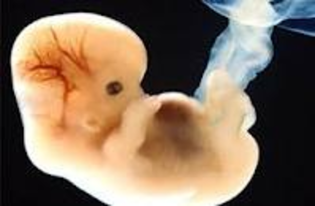 Embrión 7 semana