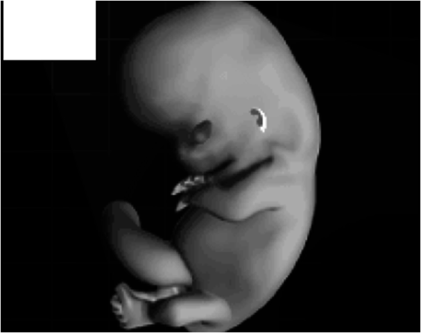 12 semanas (3 meses )