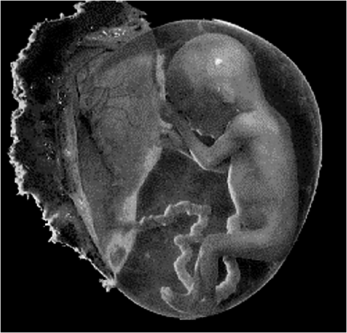 16 semanas (4 meses)