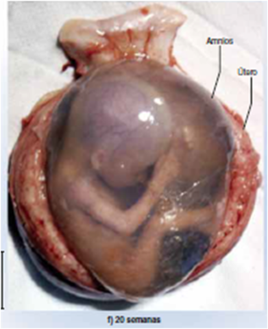 20 semanas (5 meses)