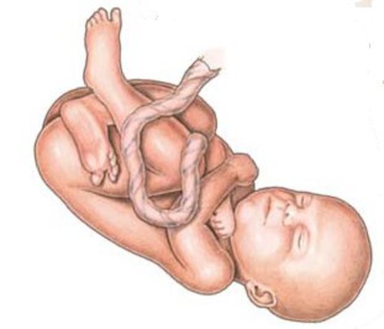 Semana 28 (7 meses).