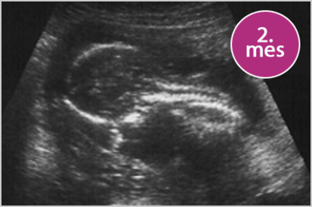 8 semanas , 2do mes