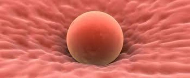 Día 7. Implantación.