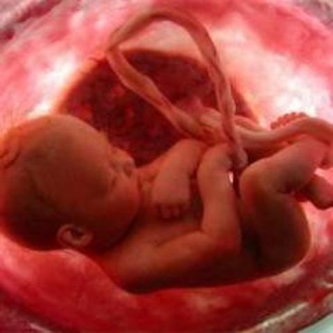 Semana 32 (8 Meses).