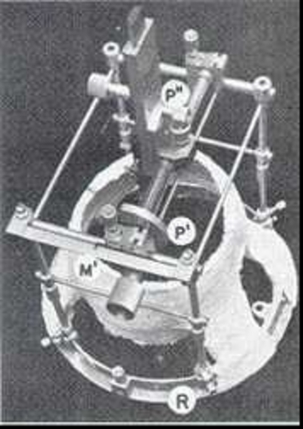 Аппарат Хорсли-Кларка