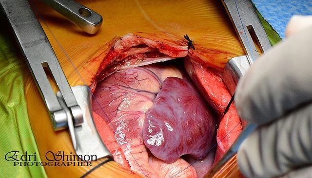 Έναρξη πληρφοριών των θεμάτων