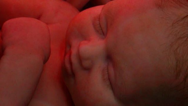 DESARROLLO DEL NIÑO LACTANTE (1° MES DE VIDA EXTRAÚTERINA)