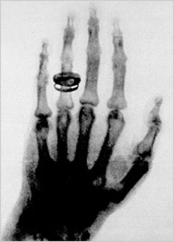 Discovery of X Rays