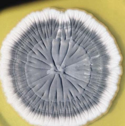 Discovery of Penicillin