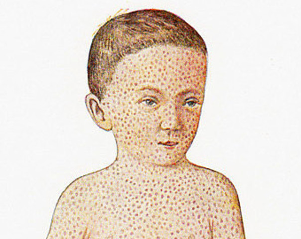 Death of his brother