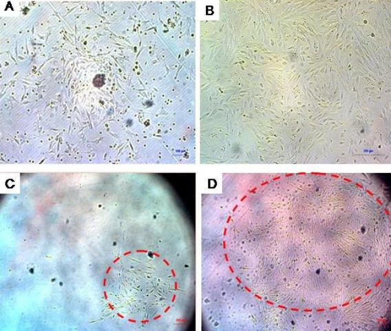 scientists find baby teeth full of stem cells
