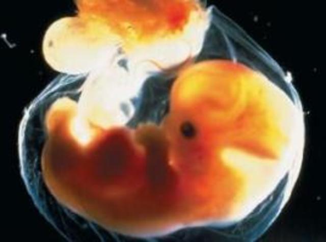 human embryos cloned to make stem cells