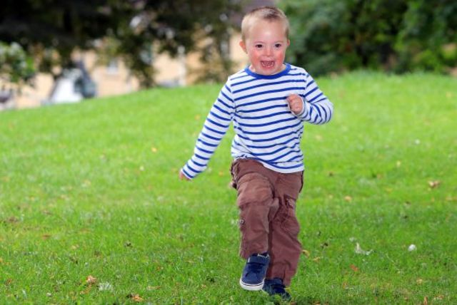 LA PSICOMOTRICIDAD  DE MANERA COTIDIANA