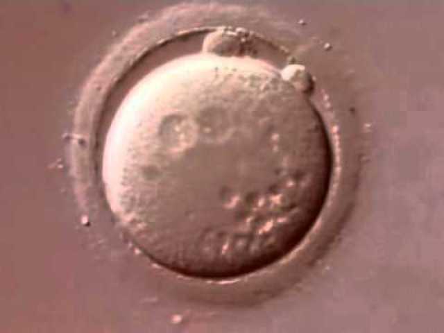 Primera Semana de Embarazo