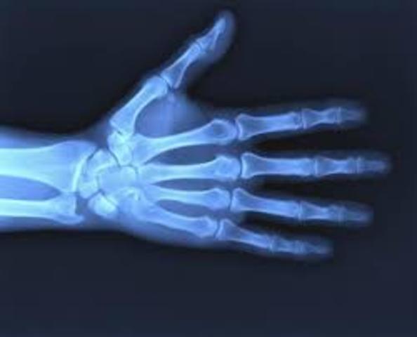 The X-rays was created by Wilhelm Roentgen
