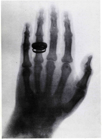 X-ray machine, Wilhelm Conrad Rontgen