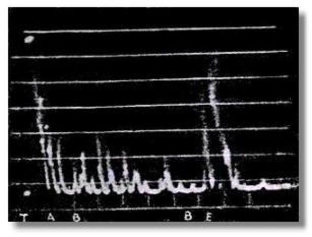 A-mode Ultrasound Equipment