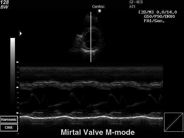 M-mode Ultrasound Instrument