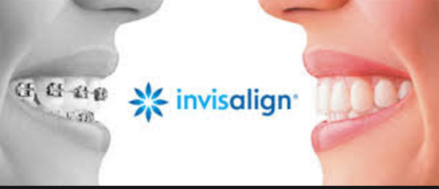 Invisalign
