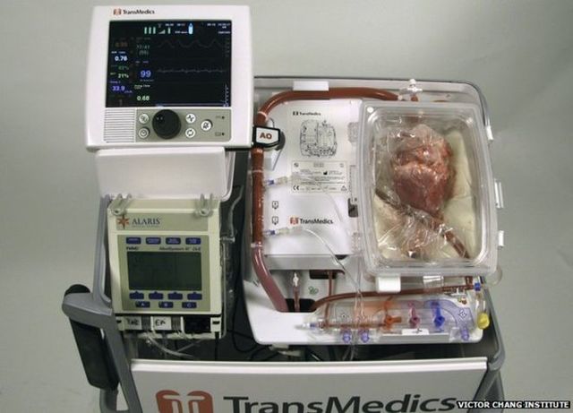 Heart Lung Machine used for Transplantation