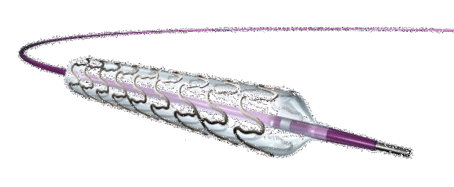 Drug Eluting Stents