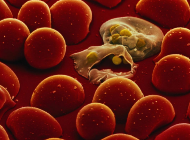 Outbreaks of Malaria (Disease)