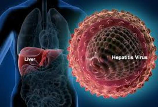 First vaccine developed for hepatitis A