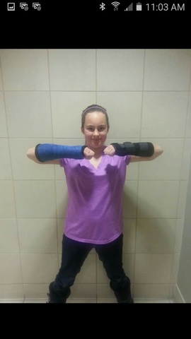 I broke my arms