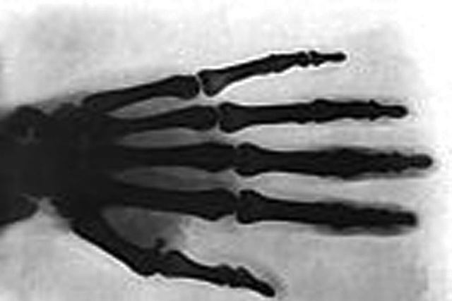 X ray was discovered