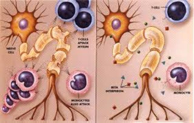 Factor de Crecimiento Nervioso
