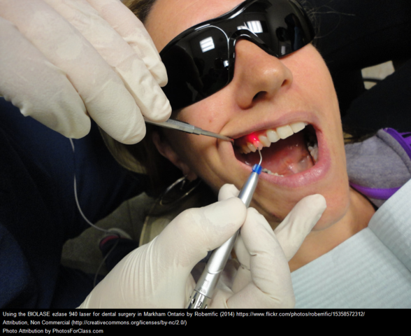Laser Dentistry