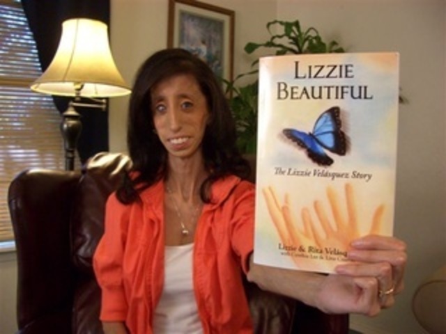 'Lizzie Beautiful', The Lizzie Velasquez story.