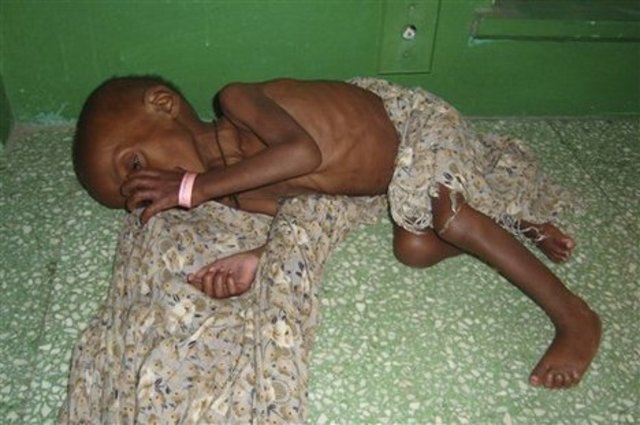 Third Pandemic of Cholera Begins