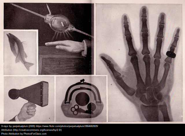 Tech Advancement- X-Ray
